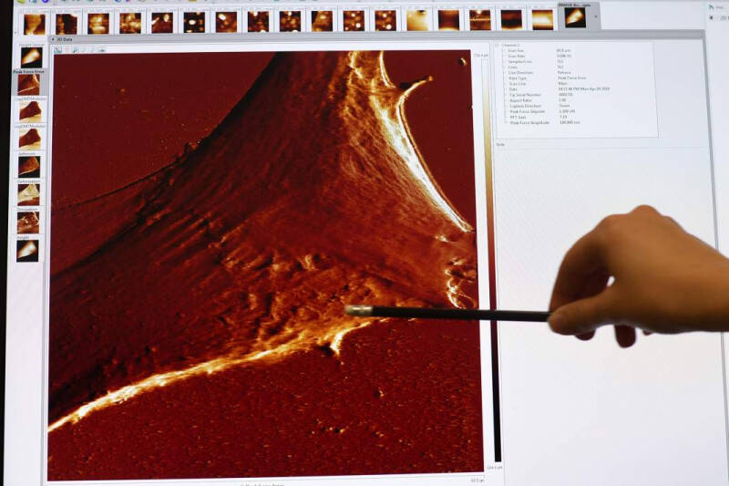 На холодном счету: в РФ научились &laquo;вечно&raquo; хранить искусственные органы