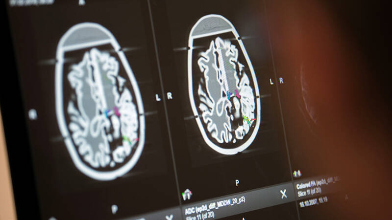 22 июля &mdash; Всемирный день мозга: история и традиции праздника